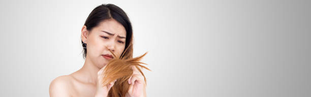 تقصف الشعر أسباب وعلاجات 