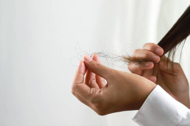 تقصف الشعر :أسباب وعلاجات